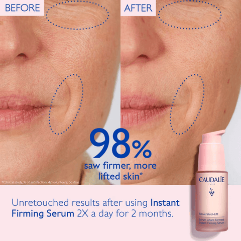 Infographic showing 98% firmer skin with Caudalie resveratrol lift