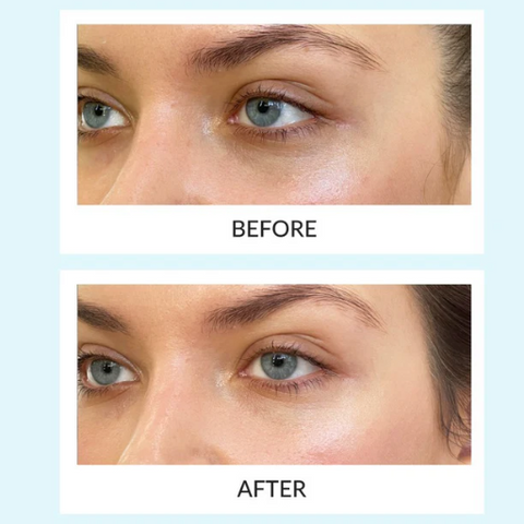 Talika before and after dark circles