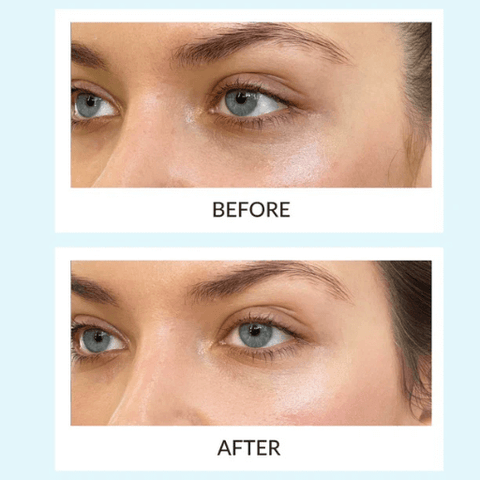 Talika before and after dark circles