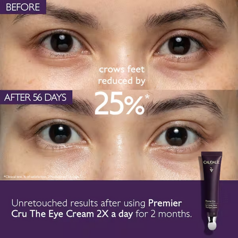 Side-by-side comparison of eyes before and after eye cream use.