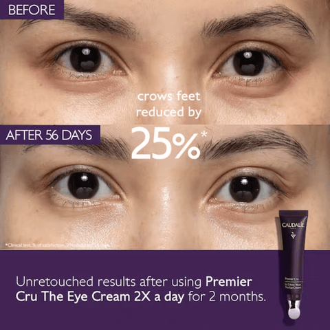 Side-by-side comparison of eyes before and after eye cream use.