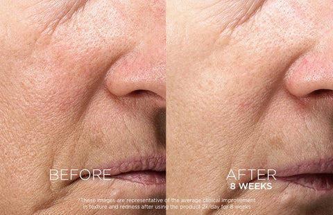 Before & After 8 weeks (2F771120)