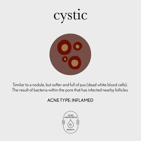 inflamed acne with pus