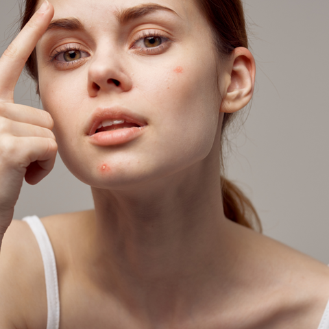 Woman with acne examining face