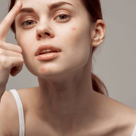 Woman with acne examining face