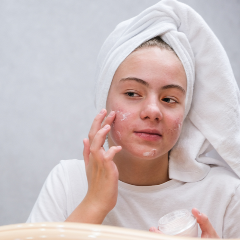 The Ins & Outs of Acne: The Means to the End ! (4)