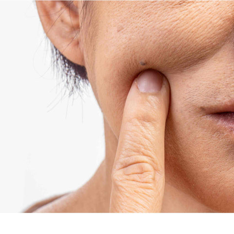 Dry skin with signs of dehydration home routine