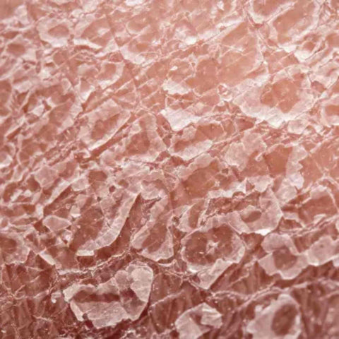 Uneven texture