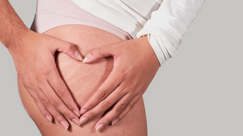 Cellulite