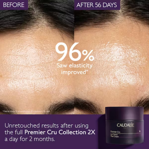 Caudalie infographic before and after forehead