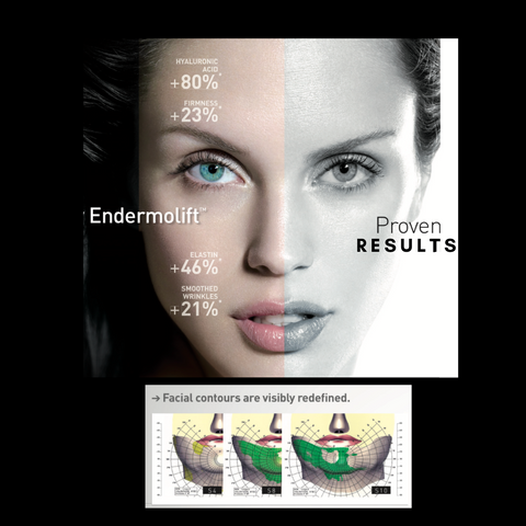 Tutorial endermolift wellbox improve face firmness by 23%