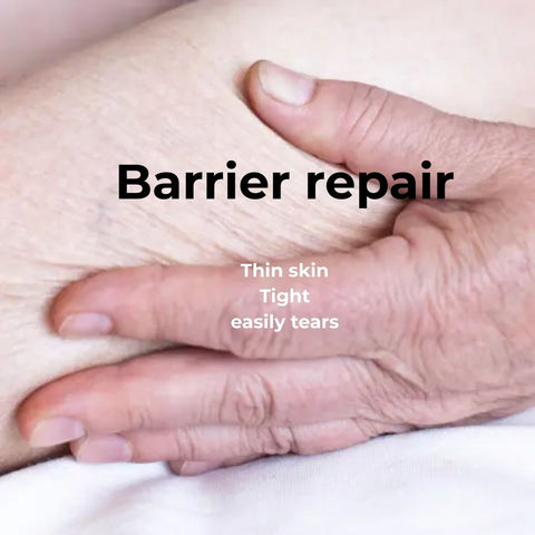 Close-up of two hands with text indicating barrier repair for thin skin that easily tears.