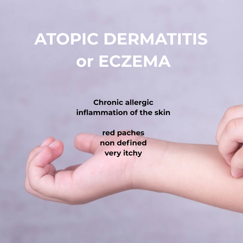 Pierre Fabre Dexeryl Emollient Cream 8.8 oz