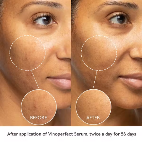 Caudalie vinoperfect serum before and after